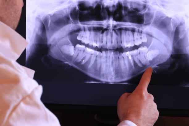 Best Pediatric Emergency Dentist in Ukiah, CA